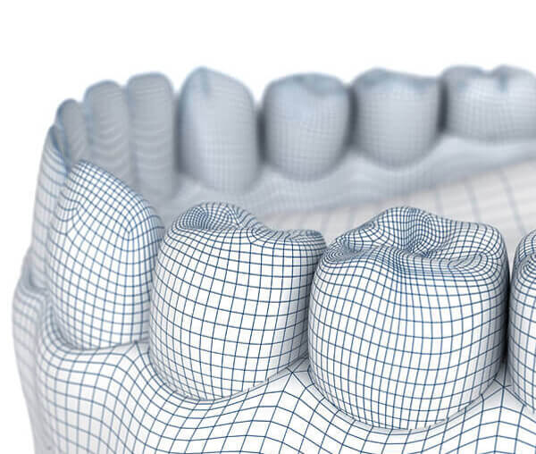 Machining - Tooth Mold